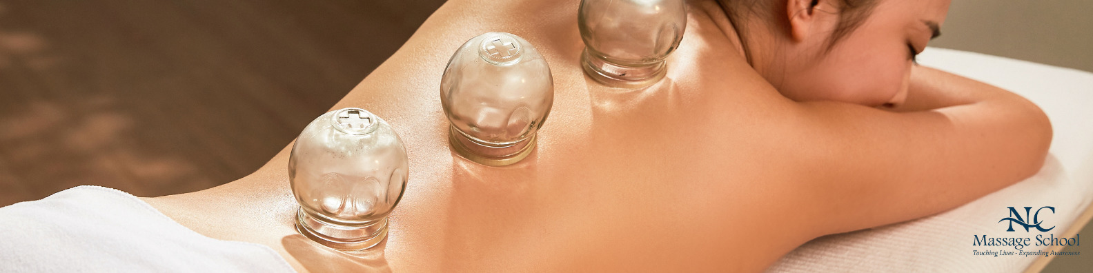 what is cupping therapy